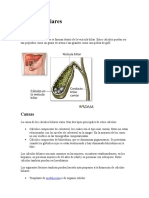 Cálculos biliares: causas, síntomas y tratamiento