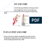 Definisi Dan Tujuan Post and Core