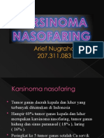 Karsinoma Nasofaring Punya Arief