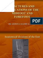 Fractures and Dislocations of The Midfoot and Forefoot