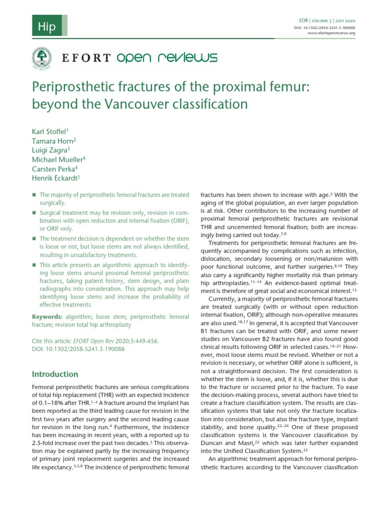 Periprosthetic Fractures of The Proximal Femur Beyond The Vancouver ...
