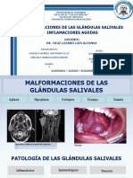 Sialoadenitis Aguda Bacteriana y Vírica