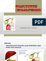 cholecystitisdancholelithiasis-160702172110