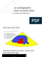 Echocardiographic Evaluation of Aortic Valve