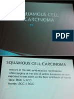 Lecture 8 - Squamous Cell Carcinoma Dr Del Rio