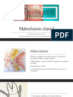 Maloclusion Clase I