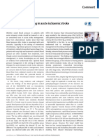 Descenso de Presion Arterial en Stroke Trombolisqdo