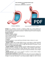 Medicina Interna II Gastroenterologie Esofagita Caustica Curs II