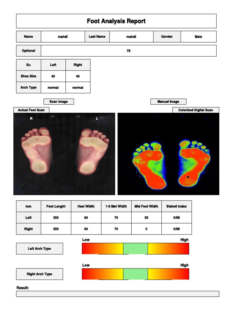 Comprehensive Foot Analysis Report | PDF