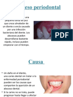 AbscesoPeriodontalCausasSíntomasTratamiento