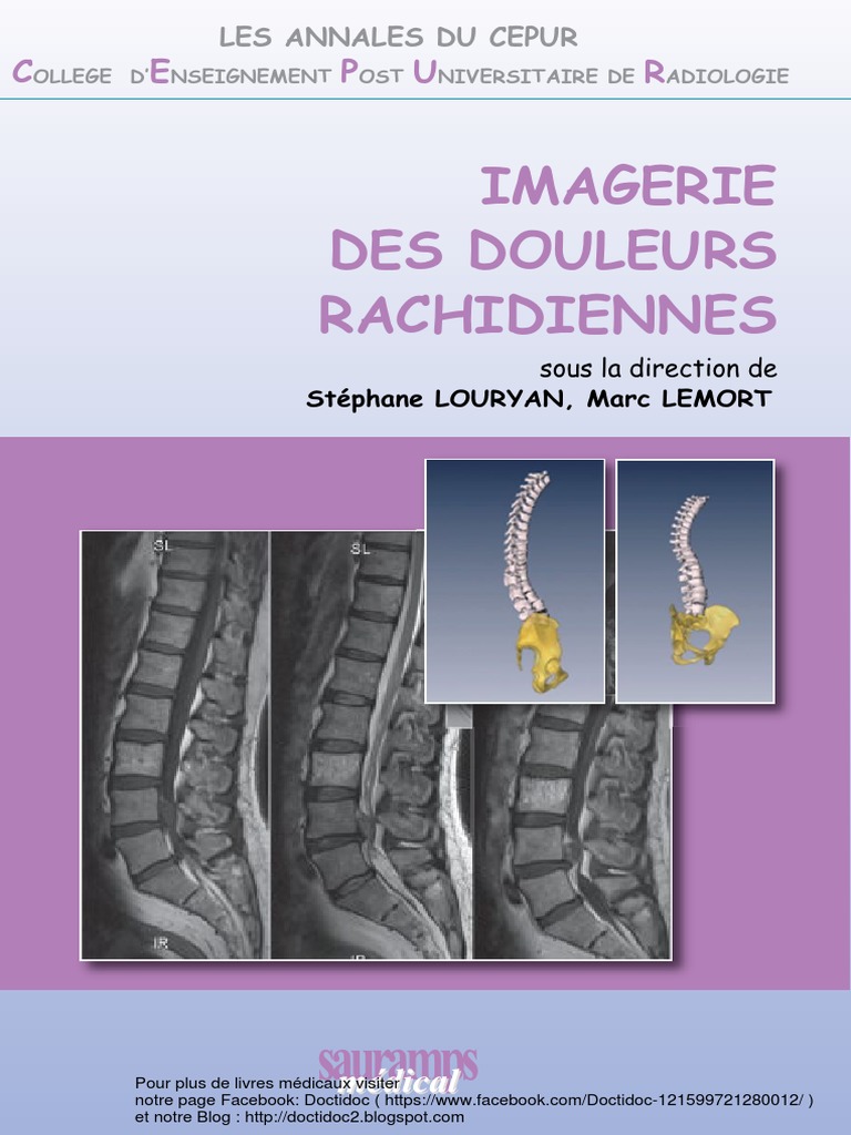 Imagerie Des Douleurs Rachidiennes | PDF | Vertèbre | Anatomie humaine