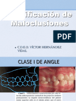 Clasificacion Maloclusiones 