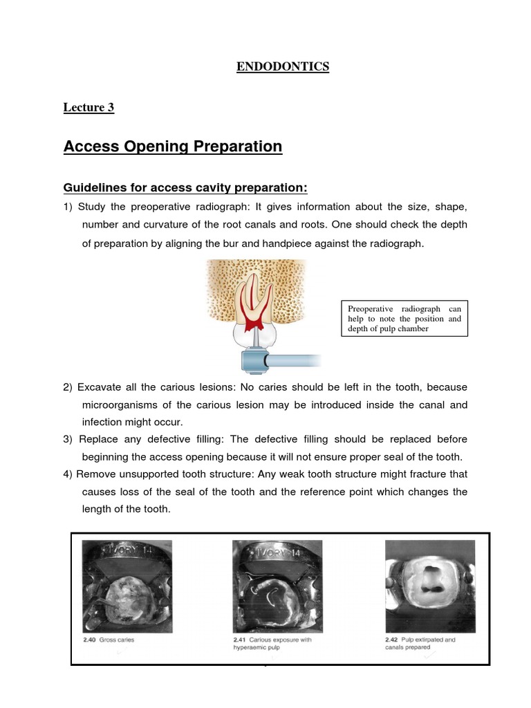 Access Opening Preparation Endodontics Pdf Mouth Dentistry