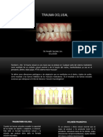 Trauma Oclusal