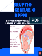 Desprendimiento Prematuro de Placenta Normoinserta