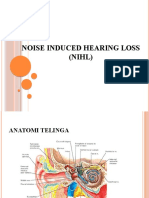NIHL-Noise Induced Hearing Loss