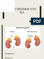 Phiochromocytoma