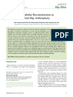 Acetabular Reconstruction in Total Hip Arthroplasty: Editorial