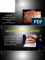 Enfilado Dental (1)