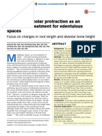 Mandibular Molar Protraction As An Alternative Treatment For Edentulous Spaces