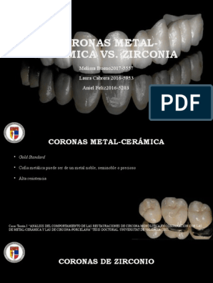 Corona metal cerámica alta estética sobre implante – Porcelab