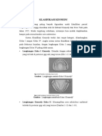 Klasifikasi Kennedy: Lengkungan Kelas I Kennedy: Ditandai Dengan Edentulous Bilateral Area