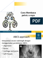 Membaca Ro Pelvis