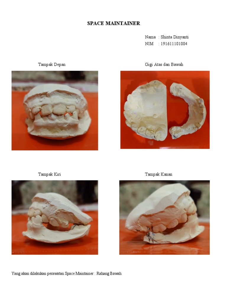 Space Maintainer PDF