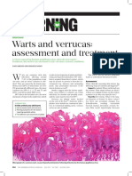Assessing and Treating Common Skin Warts and Verrucas