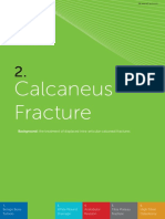 Calcaneous Fracture Surgical Technique Products BVF