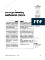 Concordancia Electroencefalográfica-Tomográfica en Pacientes Pediátricos Con Epilepsia