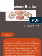 Inseminasi Buatan