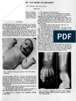 Early signs of cretinism in a 6-month-old child