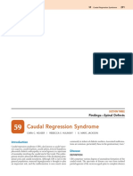 Caudal Regression Syndrome: Disease