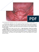 Patologia Oral e Maxilofacial Neville 4 Ed - 0012