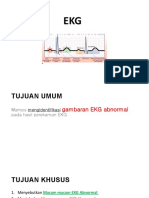 EKG ABNORMAL Eko