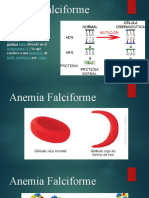 Anemia Falciforme