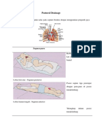 Precaution Vibration Drainage