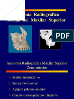 Anatomía Radiográfica Maxilar Superior