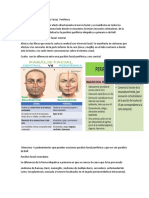 Paralisis Facial