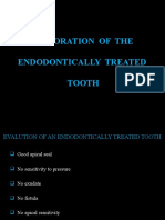 14 Endodontically Restored Teeth