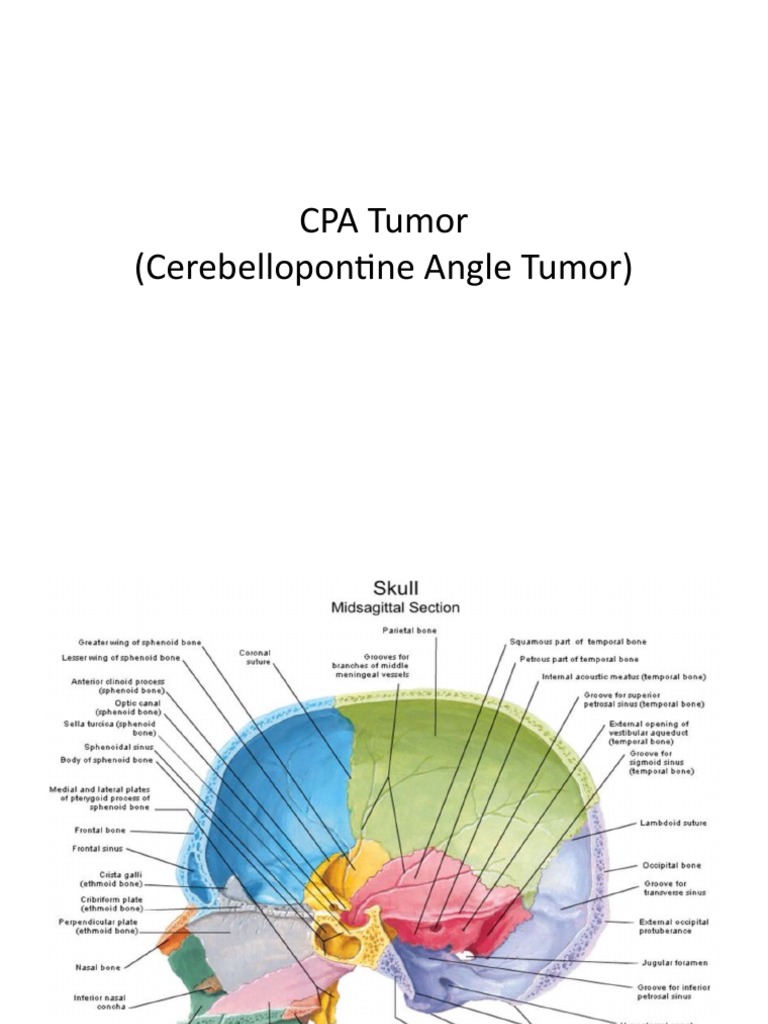 cerebellopontine-angle-tumor-overview-pdf