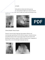 Gambaran Radiografis Odontoma Compleks&Compound
