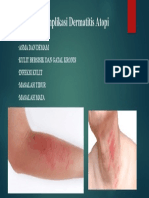 Komplikasi Dermatitis Atopi