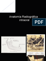 anatomiaradiogrficamaxilarymandbulaussrx-140214172028-phpapp01