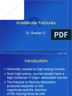 Acetabular Fractures