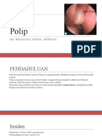 Polip Hidung