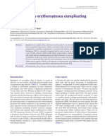 Systemic Lupus Erythematosus Complicating Simple Silicosis: Case Report