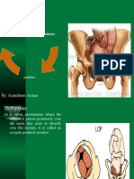 Occipito Posterior (Position