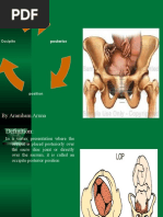 Mechanism of Labor in OP Position | PDF | Pelvis | Childbirth